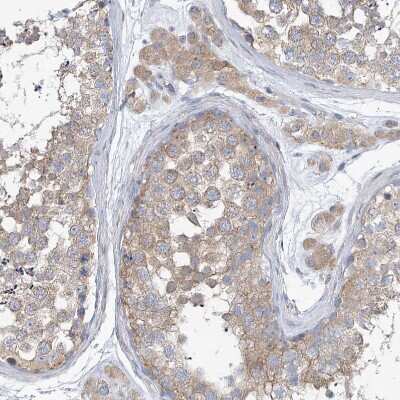 Immunohistochemistry-Paraffin: UFL1 Antibody [NBP1-90692]