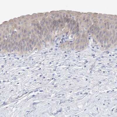 Immunohistochemistry-Paraffin: UFL1 Antibody [NBP1-90693]