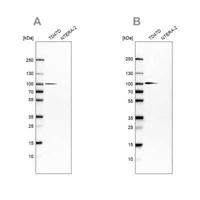 Western Blot: UFL1 Antibody [NBP1-90691]