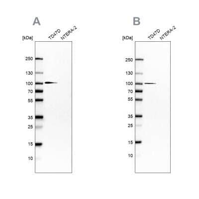 Western Blot: UFL1 Antibody [NBP1-90692]