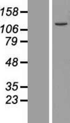 Western Blot: UFL1 Overexpression Lysate [NBL1-12255]