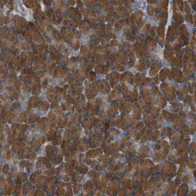 Immunohistochemistry-Paraffin: UFM1 Activating Enzyme/UBA5 Antibody [NBP1-82087]