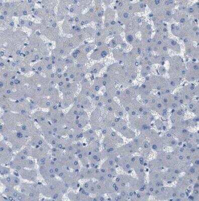 Immunohistochemistry-Paraffin: UFM1 Activating Enzyme/UBA5 Antibody [NBP1-82087]