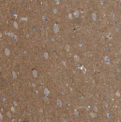 Immunohistochemistry-Paraffin: UFM1 Activating Enzyme/UBA5 Antibody [NBP1-82087]