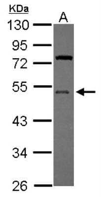 Western Blot: UFM1 Activating Enzyme/UBA5 Antibody [NBP2-20778]