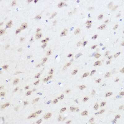 Immunohistochemistry-Paraffin: UFM1 Antibody - Azide and BSA Free [NBP2-94235]