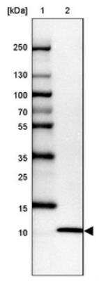 Western Blot: UFM1 Antibody [NBP1-88977]