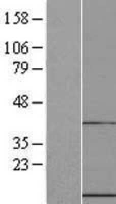 Western Blot: UFM1 Overexpression Lysate [NBL1-17589]