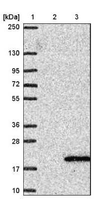 Western Blot: UFSP1 Antibody [NBP1-80643]