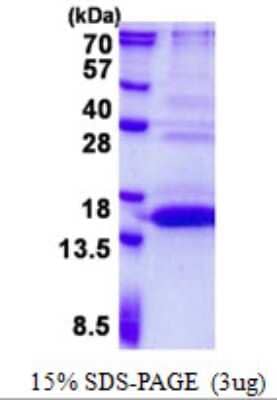 SDS-PAGE: Recombinant Human UFSP1 His Protein [NBP2-22929]