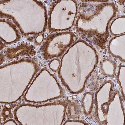 Immunohistochemistry-Paraffin: UFSP2 Antibody [NBP1-86781]