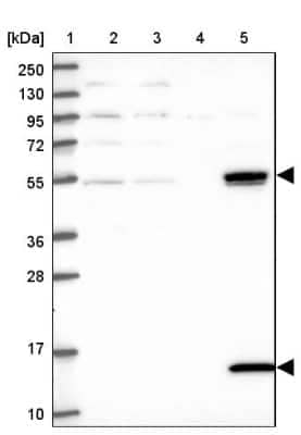 Western Blot: UFSP2 Antibody [NBP1-86781]