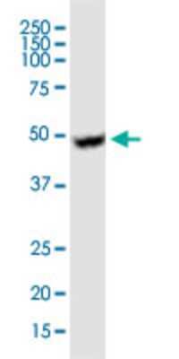 Western Blot: UGCG Antibody (1E5) [H00007357-M03]