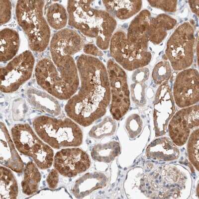 Immunohistochemistry-Paraffin: UGCG Antibody [NBP1-83376]