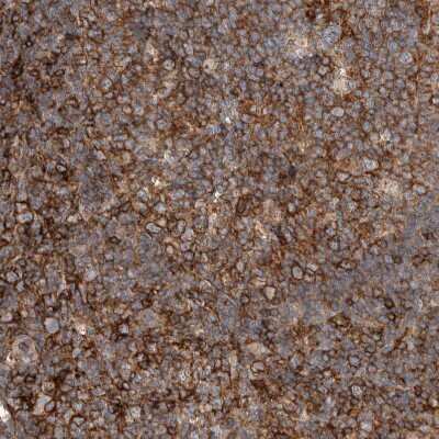 Immunohistochemistry-Paraffin: UGCG Antibody [NBP1-83376]