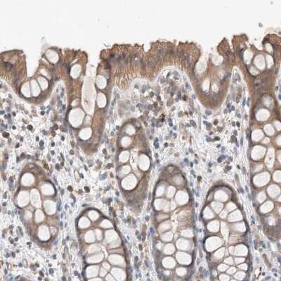 Immunohistochemistry-Paraffin: UGCG Antibody [NBP1-83376]