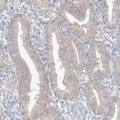 Immunohistochemistry-Paraffin: UGCG Antibody [NBP1-83376]