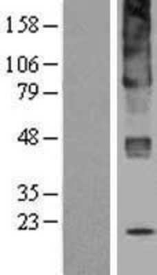 Western Blot: UGCG Overexpression Lysate [NBL1-17592]