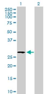 Western Blot: UGCGL2 Antibody [H00055757-B01P]