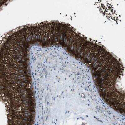 Immunohistochemistry-Paraffin: UGGT1 Antibody [NBP1-81651]