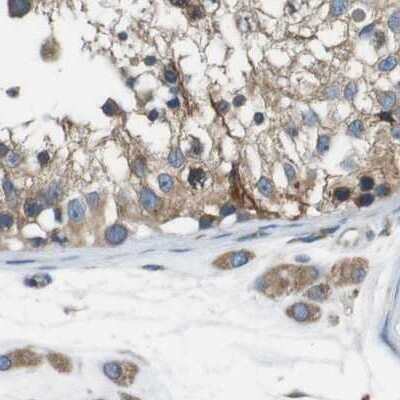 Immunohistochemistry-Paraffin: UGGT1 Antibody [NBP1-81651]