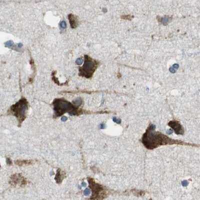 Immunohistochemistry-Paraffin: UGGT1 Antibody [NBP1-81651]