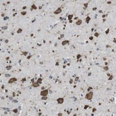Immunohistochemistry-Paraffin: UGGT1 Antibody [NBP1-81651]