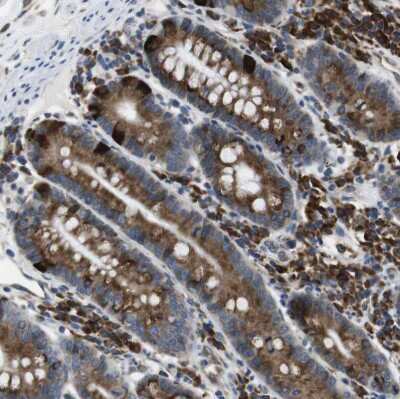 Immunohistochemistry-Paraffin: UGGT1 Antibody [NBP1-81651]