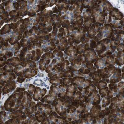 Immunohistochemistry-Paraffin: UGGT1 Antibody [NBP1-81651]