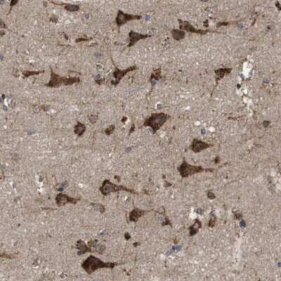 Immunohistochemistry-Paraffin: UGGT1 Antibody [NBP1-81652]