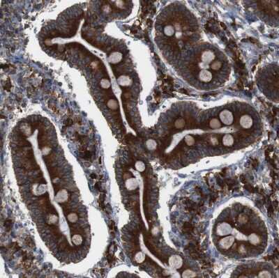 Immunohistochemistry-Paraffin: UGGT1 Antibody [NBP1-81652]