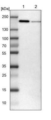 Western Blot: UGGT1 Antibody [NBP1-81652]