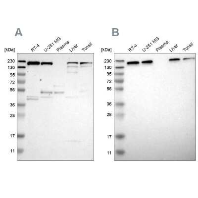 Western Blot: UGGT1 Antibody [NBP1-81652]