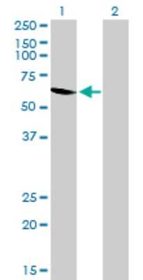 Western Blot: UGP2 Antibody (3H3) [H00007360-M01]
