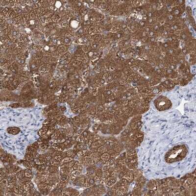 Immunohistochemistry: UGP2 Antibody [NBP2-48625]