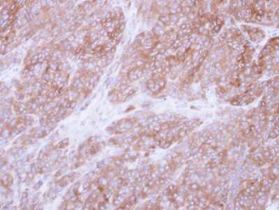 Immunohistochemistry-Paraffin: UGP2 Antibody [NBP1-32676]