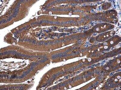 Immunohistochemistry-Paraffin: UGP2 Antibody [NBP1-32676]