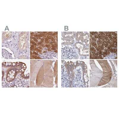 Immunohistochemistry-Paraffin: UGP2 Antibody [NBP2-49427]