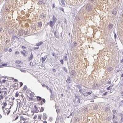 Immunohistochemistry-Paraffin: UGP2 Antibody [NBP2-49427]