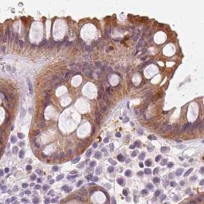 Immunohistochemistry-Paraffin: UGP2 Antibody [NBP2-49427]