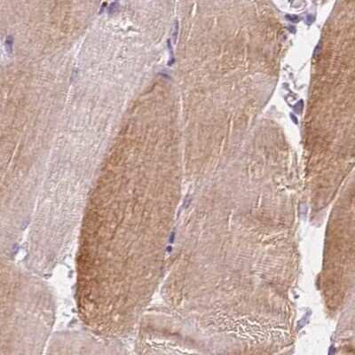 Immunohistochemistry-Paraffin: UGP2 Antibody [NBP2-49427]