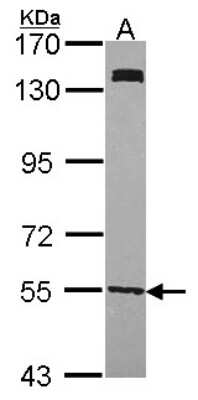 Western Blot: UGP2 Antibody [NBP1-32243]