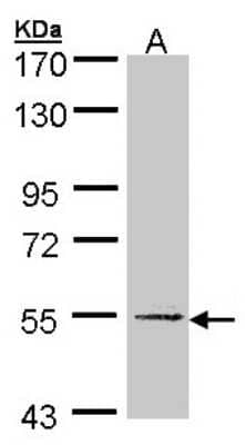 Western Blot: UGP2 Antibody [NBP1-32676]