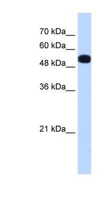 Western Blot: UGP2 Antibody [NBP1-55519]