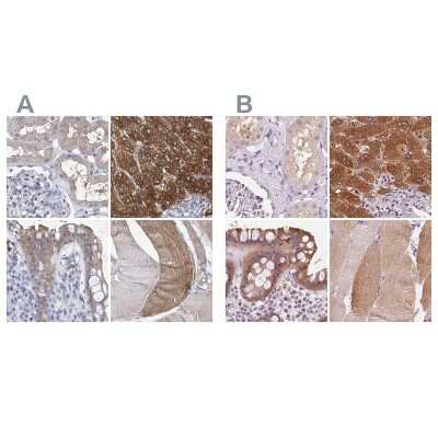 Immunohistochemistry-Paraffin: UGP2 Antibody [NBP1-85918]