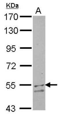 Western Blot: UGP2 Antibody [NBP2-20804]