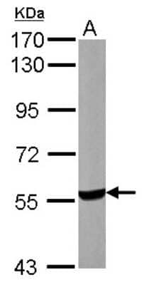 Western Blot: UGP2 Antibody [NBP2-20804]