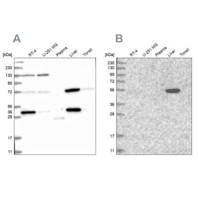 Western Blot: UGP2 Antibody [NBP2-48625]