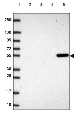 Western Blot: UGP2 Antibody [NBP2-49427]