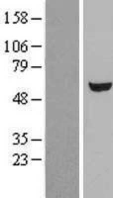 Western Blot: UGP2 Overexpression Lysate [NBL1-17595]